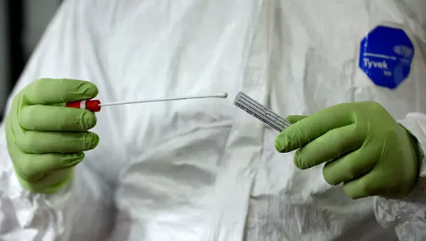 Scientists Find Achilles’ Heel of Сoronavirus Scientists Find Achilles’ Heel of Сoronavirus